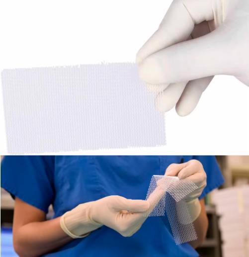 surgical polypropylene repair mesh